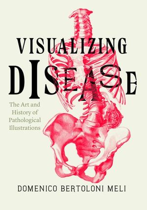 Buy Visualizing Disease at Amazon