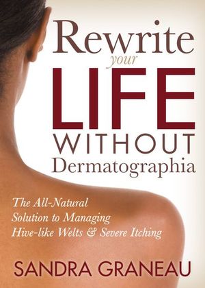 Buy Rewrite Your Life Without Dermatographia at Amazon